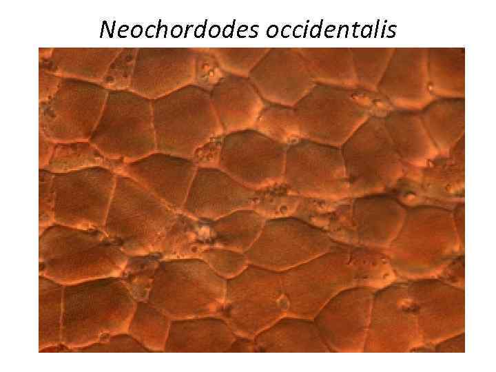 Neochordodes occidentalis 