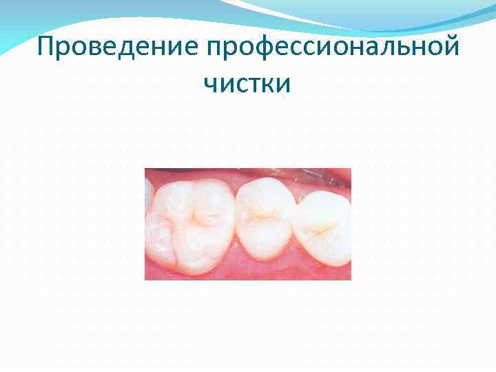 Проведение профессиональной чистки 