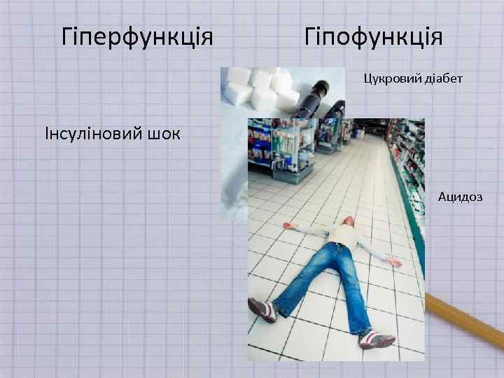 Гіперфункція Гіпофункція Цукровий діабет Інсуліновий шок Ацидоз 