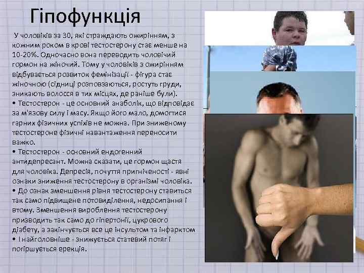 Гіпофункція У чоловіків за 30, які страждають ожирінням, з кожним роком в крові тестостерону