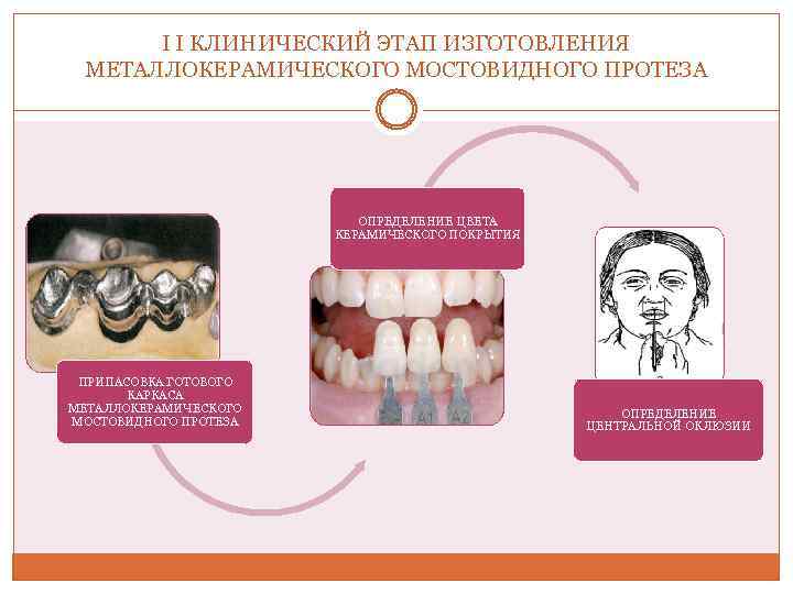 Протез определение