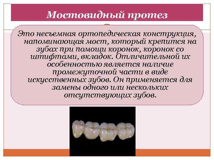 Современные компьютерные технологии ортопедического лечения дефектов коронок зубов презентация