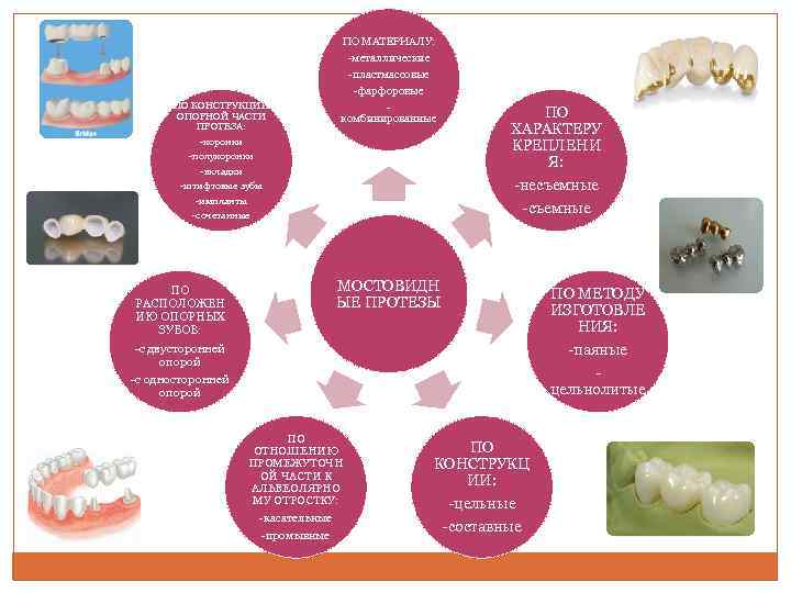 ПО КОНСТРУКЦИИ ОПОРНОЙ ЧАСТИ ПРОТЕЗА: -коронки -полукоронки -вкладки -штифтовые зубы -импланты -сочетанные ПО МАТЕРИАЛУ: