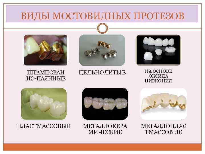 Металлокерамические мостовидные протезы презентация