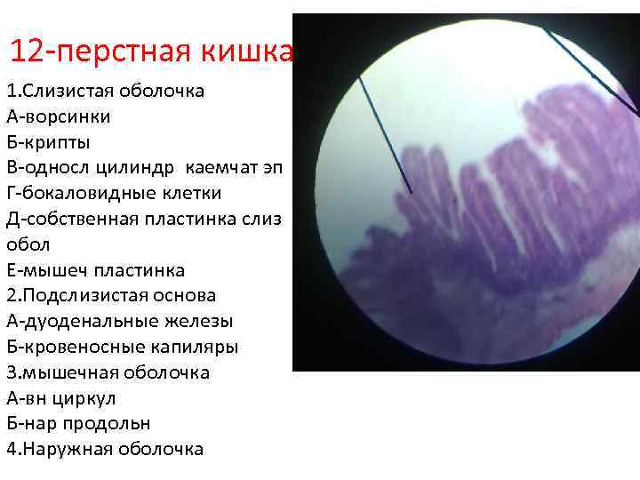 12 -перстная кишка 1. Слизистая оболочка А-ворсинки Б-крипты В-односл цилиндр каемчат эп Г-бокаловидные клетки