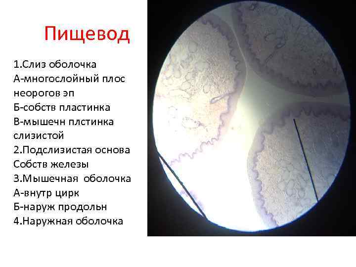 Пищевод 1. Слиз оболочка А-многослойный плос неорогов эп Б-собств пластинка В-мышечн плстинка слизистой 2.