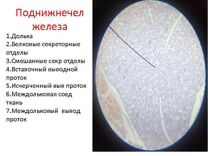 Поднижнечел железа 1. Долька 2. Белковые секреторные отделы 3. Смешанные секр отделы 4. Вставочный