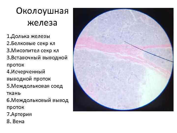 Околоушная железа 1. Долька железы 2. Белковые секр кл 3. Миоэпител секр кл 3.