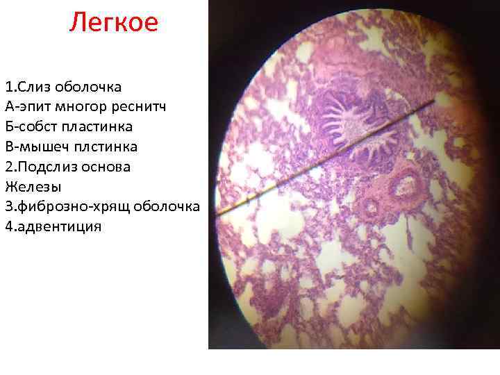 Легкое 1. Слиз оболочка А-эпит многор реснитч Б-собст пластинка В-мышеч плстинка 2. Подслиз основа