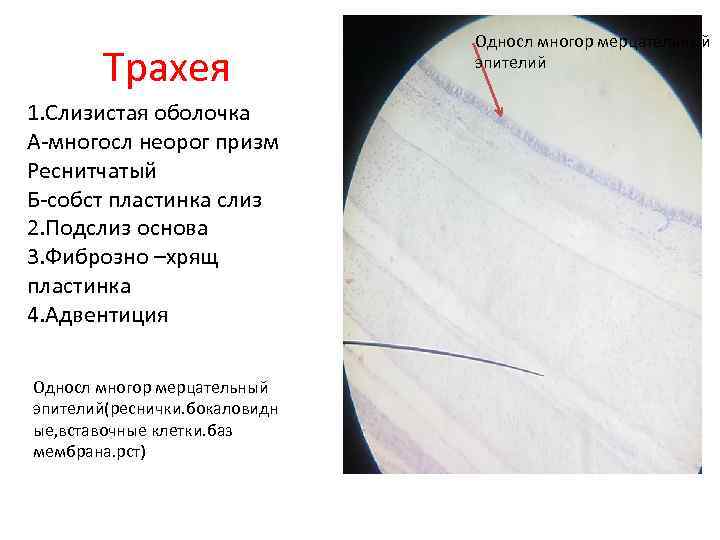 Трахея 1. Слизистая оболочка А-многосл неорог призм Реснитчатый Б-собст пластинка слиз 2. Подслиз основа