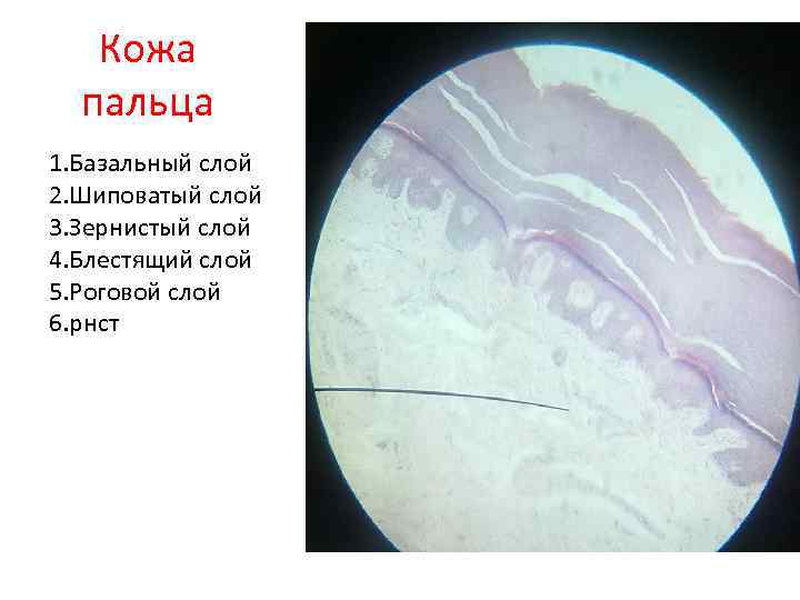 Кожа пальца 1. Базальный слой 2. Шиповатый слой 3. Зернистый слой 4. Блестящий слой