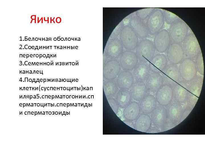 Яичко 1. Белочная оболочка 2. Соединит тканные перегородки 3. Семенной извитой каналец 4. Поддерживающие