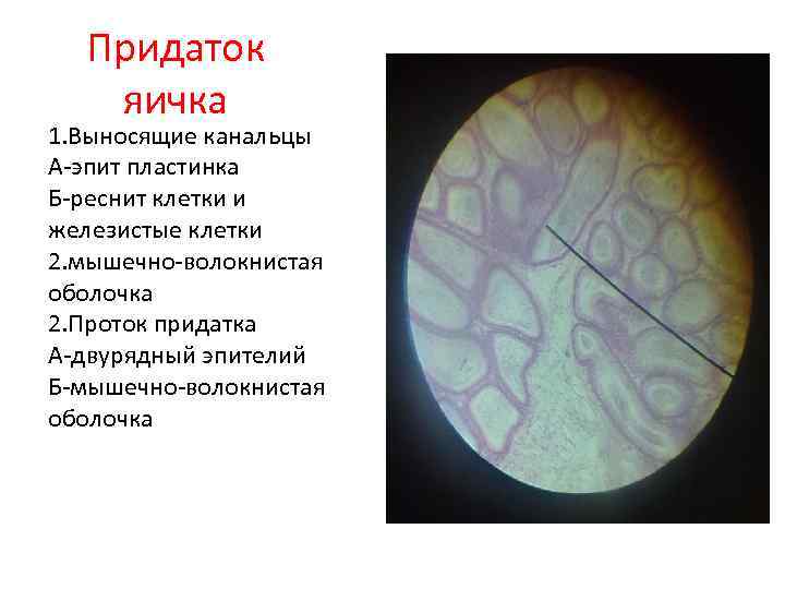 Придаток яичка 1. Выносящие канальцы А-эпит пластинка Б-реснит клетки и железистые клетки 2. мышечно-волокнистая