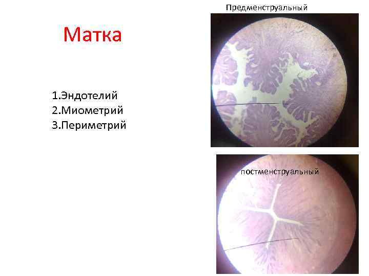 Предменструальный Матка 1. Эндотелий 2. Миометрий 3. Периметрий постменструальный 