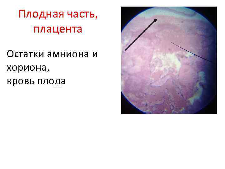 Плодная часть, плацента Остатки амниона и хориона, кровь плода 