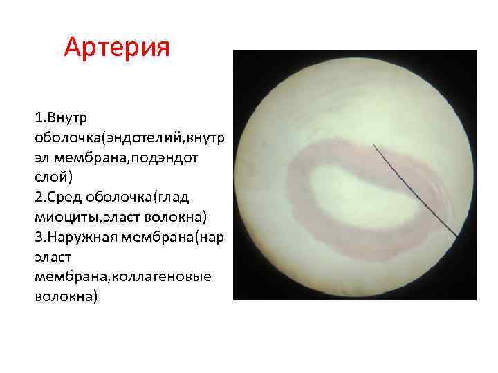 Артерия 1. Внутр оболочка(эндотелий, внутр эл мембрана, подэндот слой) 2. Сред оболочка(глад миоциты, эласт