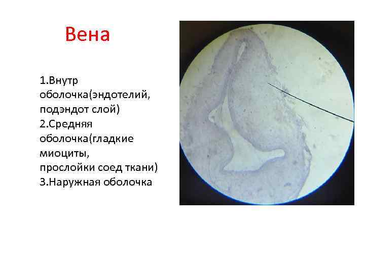 Вена 1. Внутр оболочка(эндотелий, подэндот слой) 2. Средняя оболочка(гладкие миоциты, прослойки соед ткани) 3.