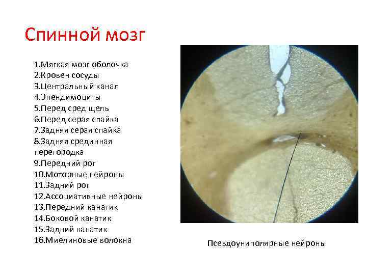 Спинной мозг 1. Мягкая мозг оболочка 2. Кровен сосуды 3. Центральный канал 4. Эпендимоциты