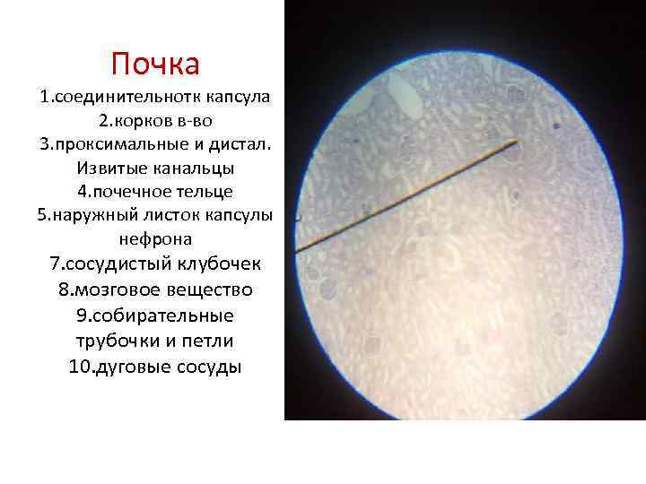 Почка 1. соединительнотк капсула 2. корков в-во 3. проксимальные и дистал. Извитые канальцы 4.