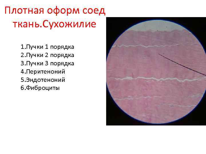 Плотная оформ соед ткань. Сухожилие 1. Пучки 1 порядка 2. Пучки 2 порядка 3.