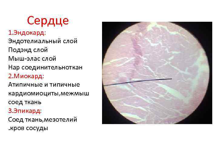 Сердце 1. Эндокард: Эндотелиальный слой Подэнд слой Мыш-элас слой Нар соединительноткан 2. Миокард: Атипичные