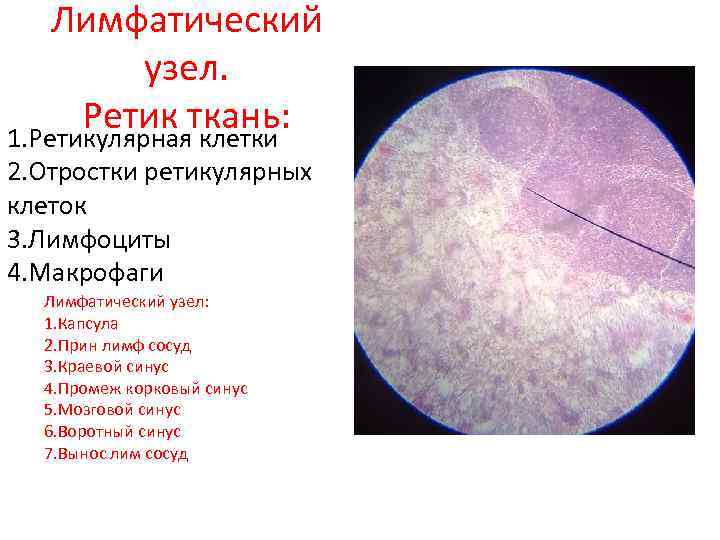 Лимфатический узел. Ретик ткань: 1. Ретикулярная клетки 2. Отростки ретикулярных клеток 3. Лимфоциты 4.