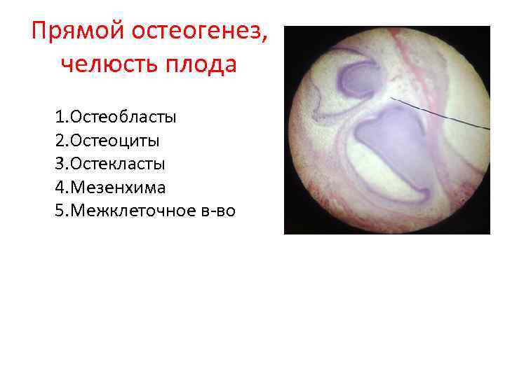 Прямой остеогенез, челюсть плода 1. Остеобласты 2. Остеоциты 3. Остекласты 4. Мезенхима 5. Межклеточное