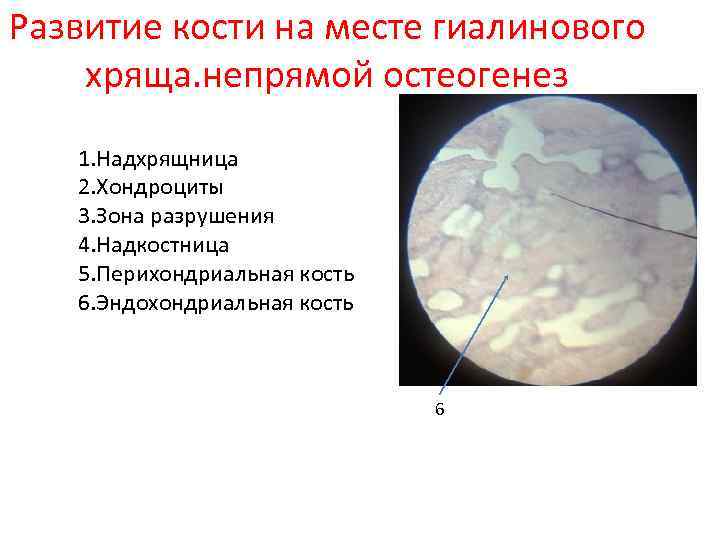 Развитие кости на месте гиалинового хряща. непрямой остеогенез 1. Надхрящница 2. Хондроциты 3. Зона