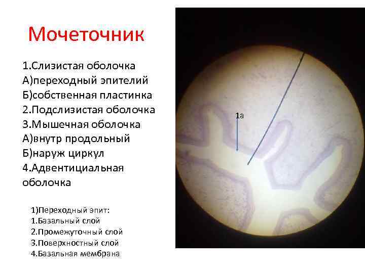 Мочеточник 1. Слизистая оболочка А)переходный эпителий Б)собственная пластинка 2. Подслизистая оболочка 3. Мышечная оболочка