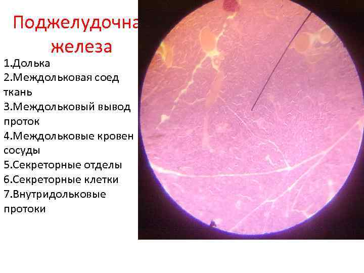 Поджелудочная железа 1. Долька 2. Междольковая соед ткань 3. Междольковый вывод проток 4. Междольковые