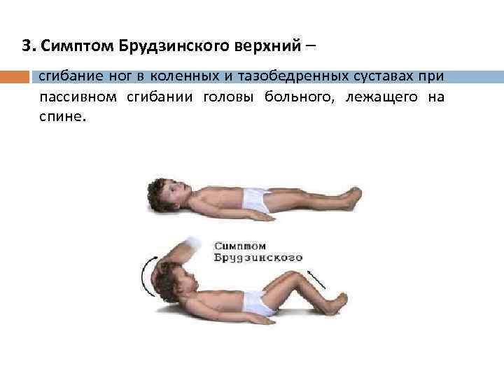 3. Симптом Брудзинского верхний – сгибание ног в коленных и тазобедренных суставах при пассивном