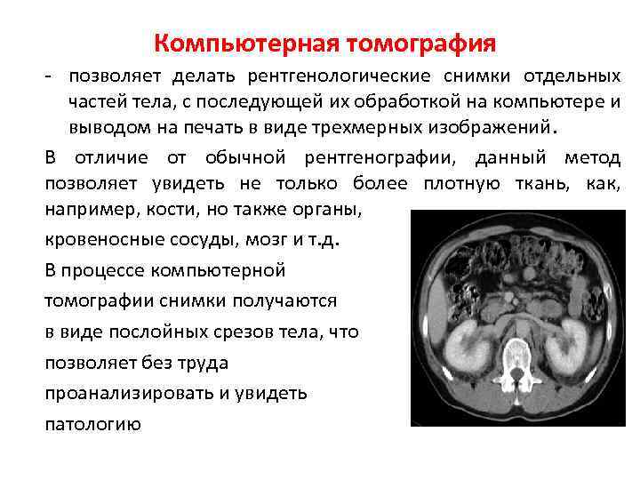 Компьютерная томография - позволяет делать рентгенологические снимки отдельных частей тела, с последующей их обработкой