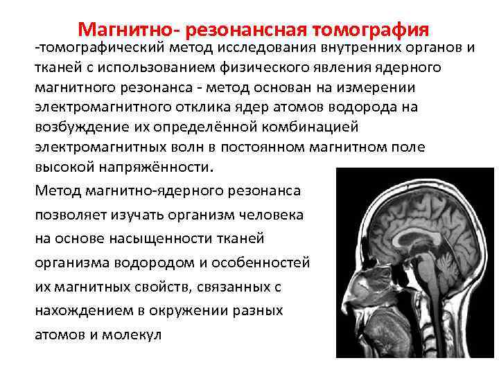 Магнитно- резонансная томография -томографический метод исследования внутренних органов и тканей с использованием физического явления