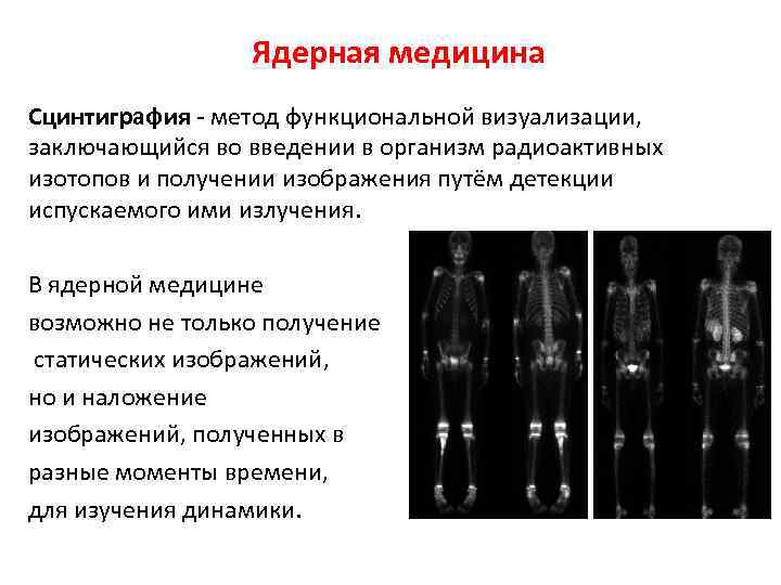 Ядерная медицина Сцинтиграфия - метод функциональной визуализации, заключающийся во введении в организм радиоактивных изотопов