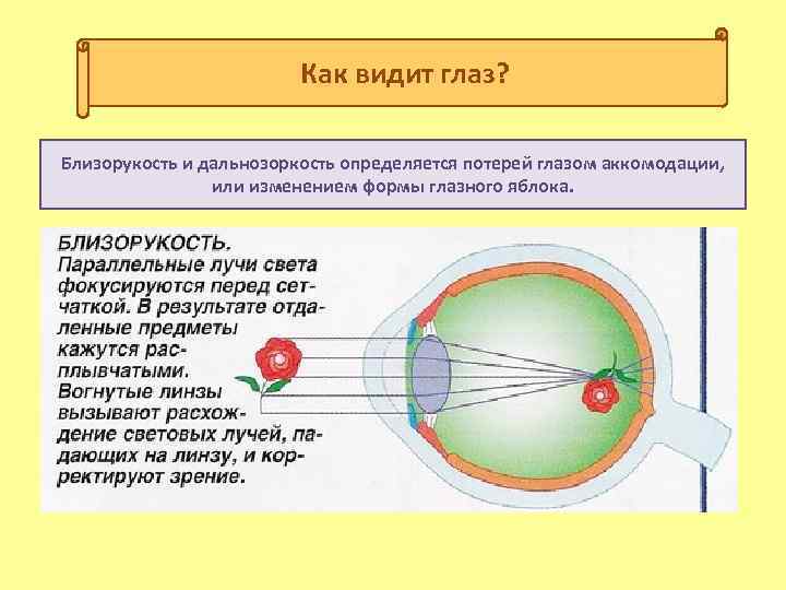 Изображение в близоруком глазу фиксируется