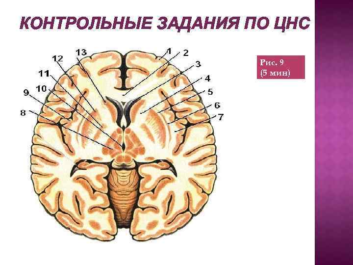 КОНТРОЛЬНЫЕ ЗАДАНИЯ ПО ЦНС Рис. 9 (5 мин) 