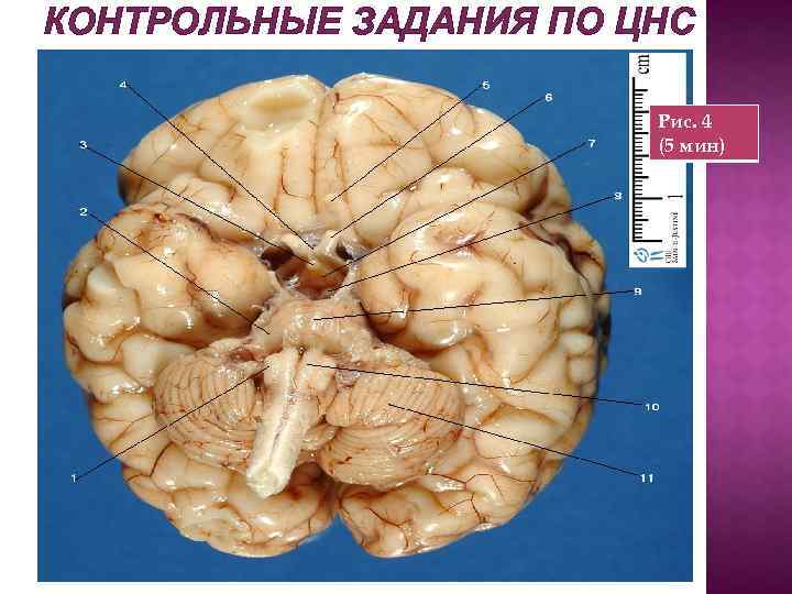 КОНТРОЛЬНЫЕ ЗАДАНИЯ ПО ЦНС Рис. 4 (5 мин) 