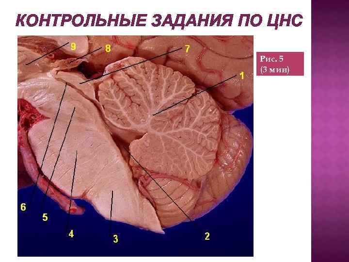 КОНТРОЛЬНЫЕ ЗАДАНИЯ ПО ЦНС Рис. 5 (3 мин) 