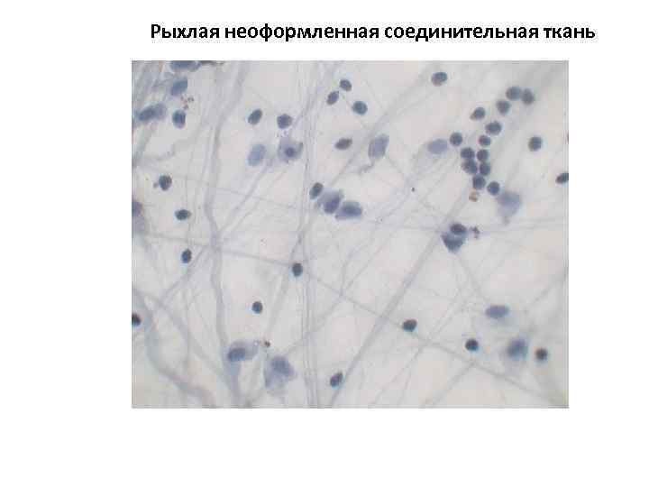 Рыхлая ткань. Рыхлая неоформленная соединительная ткань. Рыхлая волокнистая неоформленная соединительная ткань гистология. Рыхлая неоформленная соединительная ткань препарат. Рыхлая соединительная ткань микропрепарат.