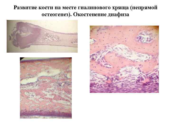 Развитие кости на месте гиалинового хряща (непрямой остеогенез). Окостенение диафиза 