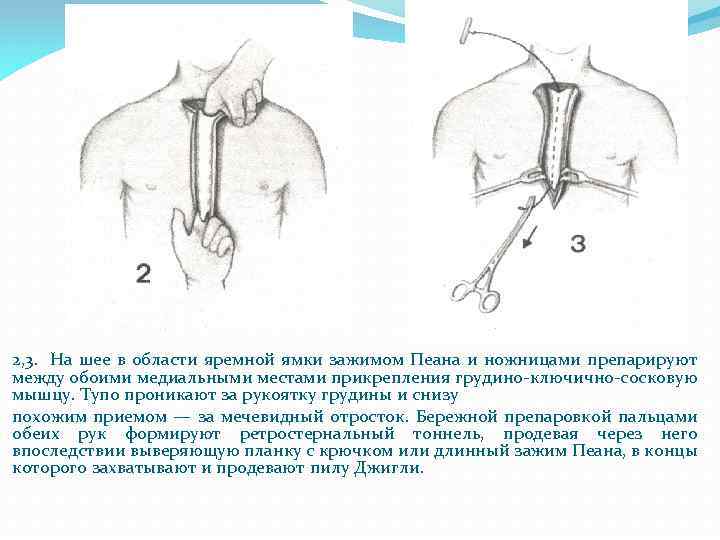 Где у человека яремная впадина