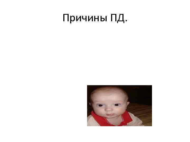 Причины ПД. 