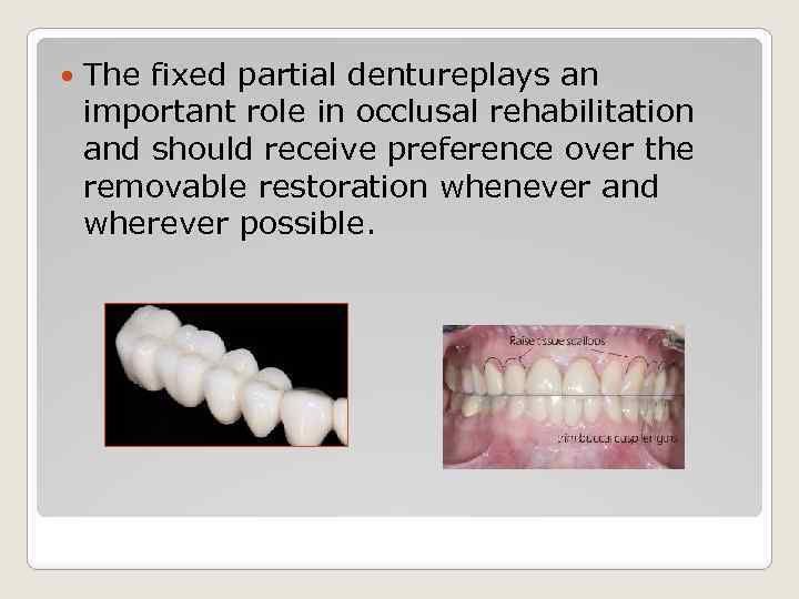  The fixed partial dentureplays an important role in occlusal rehabilitation and should receive
