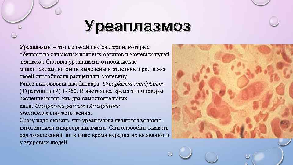 Уреаплазмоз лечение