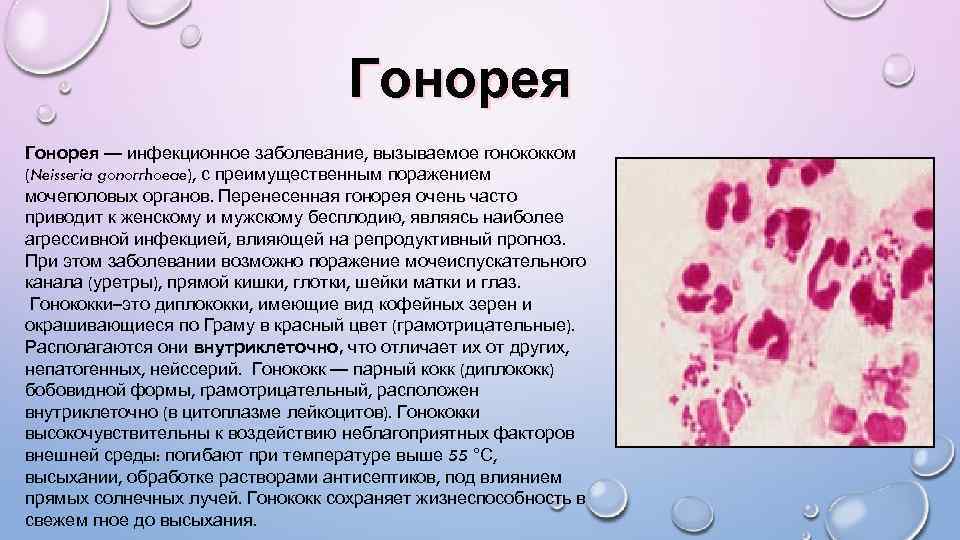 Гонорея — инфекционное заболевание, вызываемое гонококком (Neisseria gonorrhoeae), с преимущественным поражением мочеполовых органов. Перенесенная