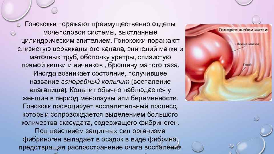 Гонококки поражают преимущественно отделы мочеполовой системы, выстланные цилиндрическим эпителием. Гонококки поражают слизистую цервикального канала,