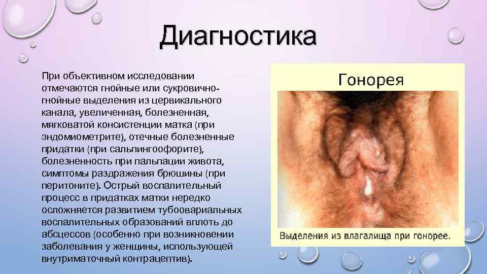 Диагностика При объективном исследовании отмечаются гнойные или сукровичногнойные выделения из цервикального канала, увеличенная, болезненная,