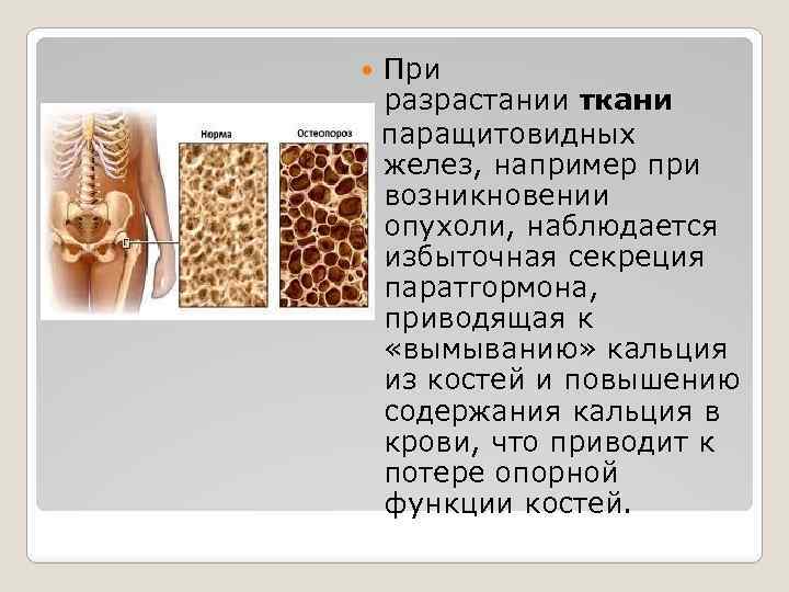 При разрастании ткани паращитовидных желез, например при возникновении опухоли, наблюдается избыточная секреция паратгормона, приводящая