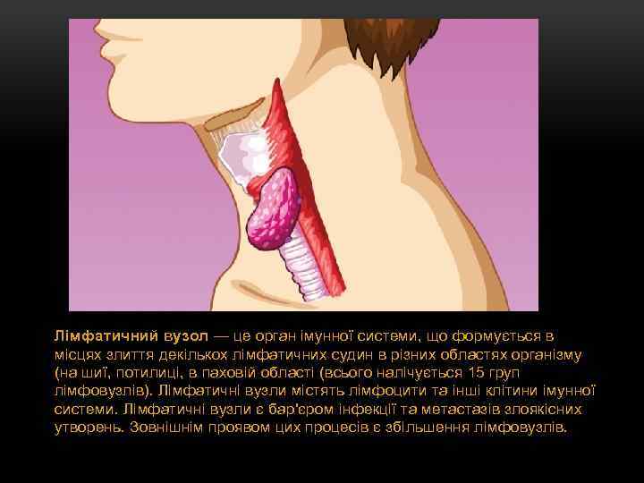 Лімфатичний вузол — це орган імунної системи, що формується в місцях злиття декількох лімфатичних