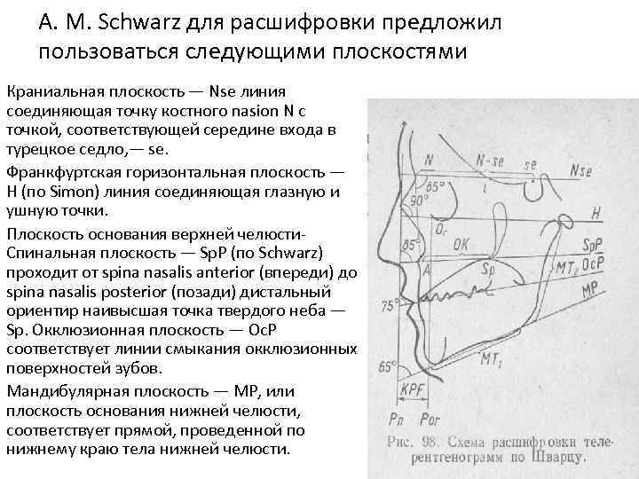 А. М. Schwarz для расшифровки предложил пользоваться следующими плоскостями Краниальная плоскость — Nse линия